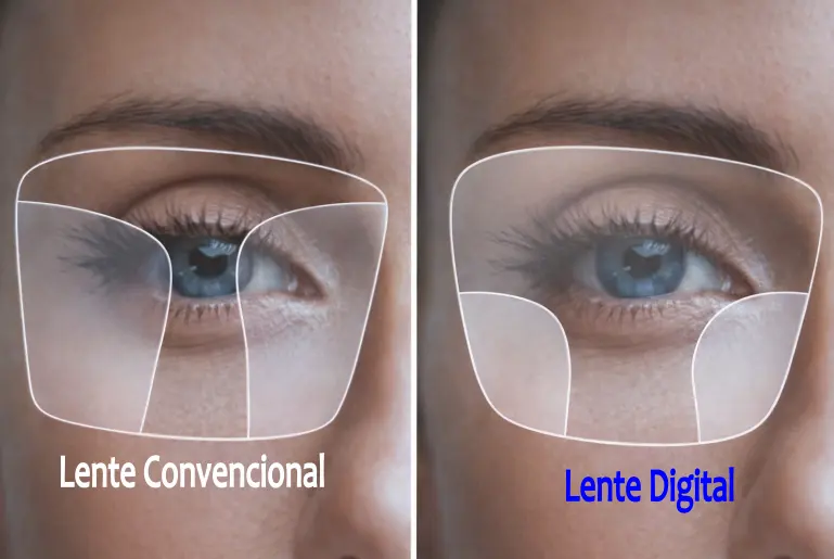 Lente Convencional vs Lente Digital